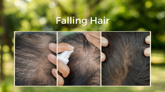 Why does my hair fall out as I get older?