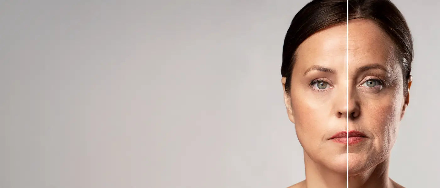 Fine Lines & Wrinkles