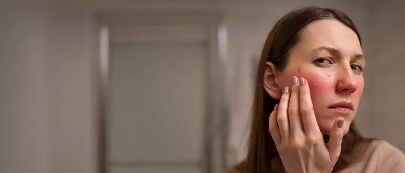 Sensitive / Redness- Prone Skin