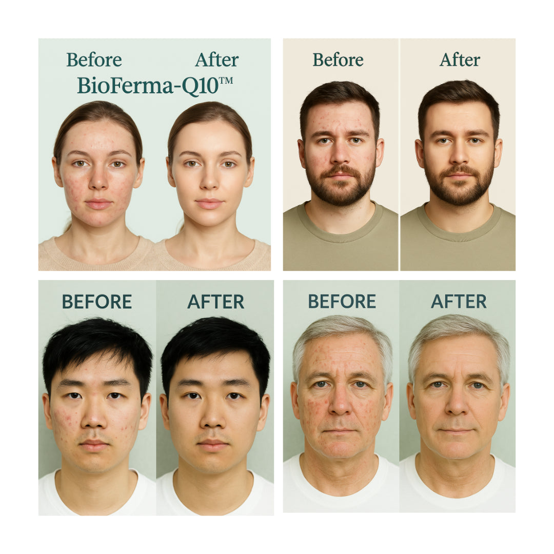 Micellar Cosmetics™ BioFerma SkinMist – Probiotic Skin Strengthening Mist 100ml