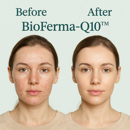 Micellar Cosmetics™ BioFerma SkinMist – Probiotic Skin Strengthening Mist 100ml