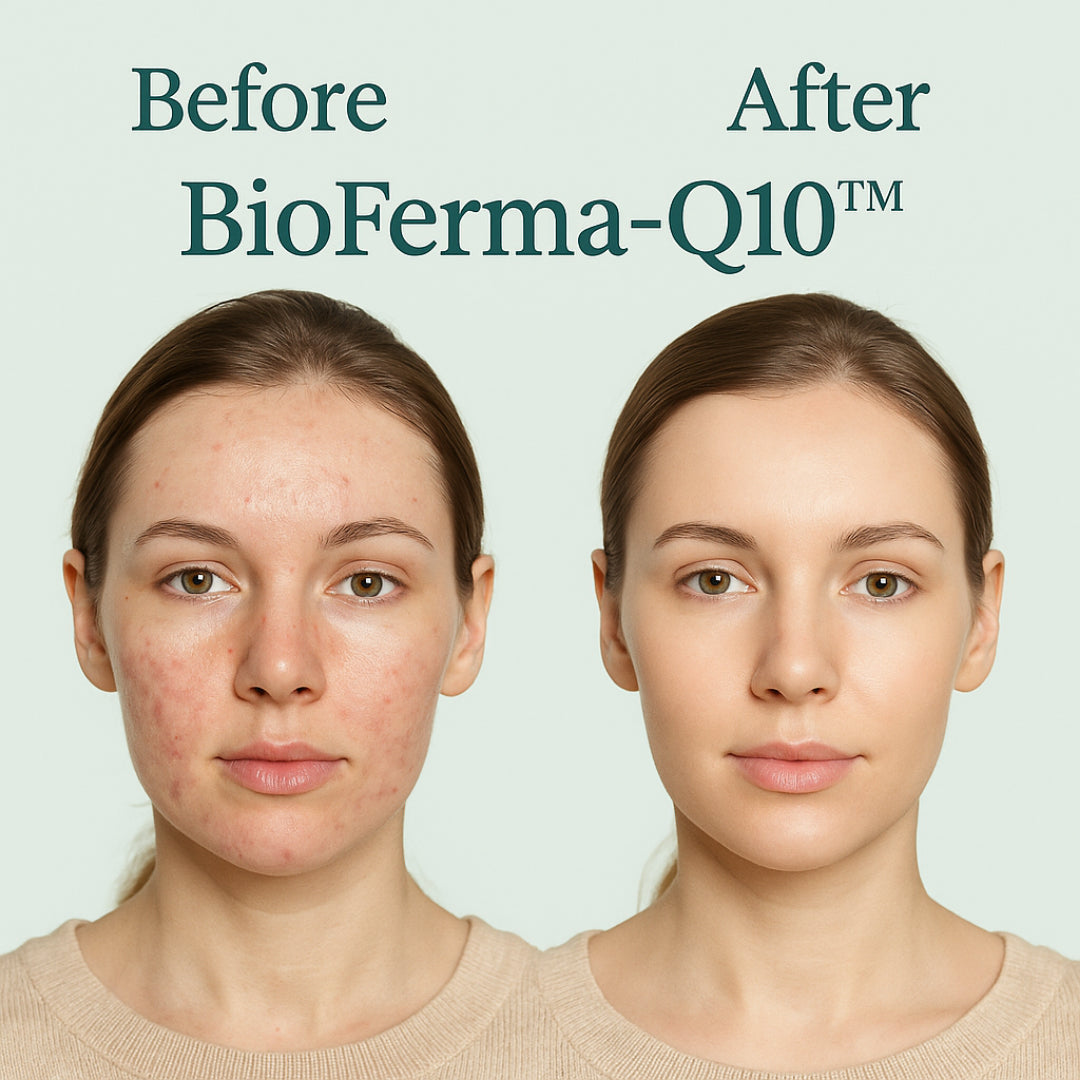 Micellar Cosmetics™ BioFerma Micellar Water – Probiotic Cleansing Water 200ml