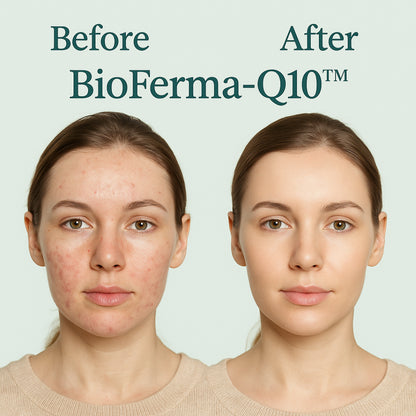 Micellar Cosmetics™ BioFerma Micellar Water – Probiotic Cleansing Water 200ml